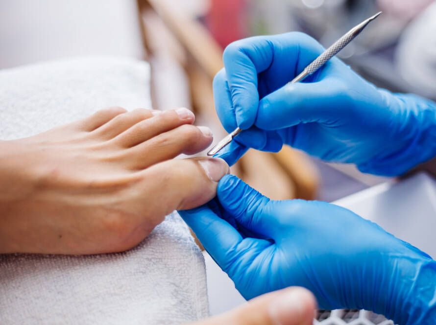 Uñas encarnadas