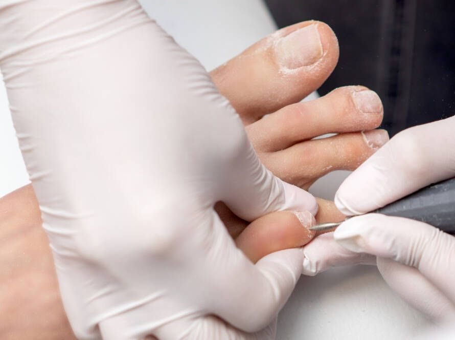 Uñas onicogrifósicas